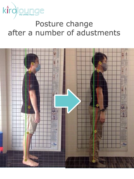 Posture Correction 2 – Kirolounge-dr. Hiro